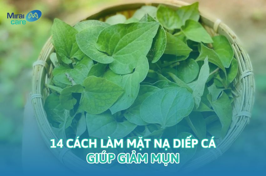 Chăm s&oacute;c da